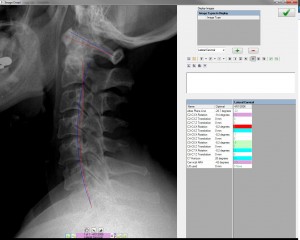 Lateral Cervical Analysis